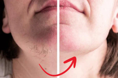 HairErase™ Hormone-based hair remover...